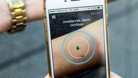 Experts waarschuwen: “Vertrouw niet blind op gezondheidsapps”
