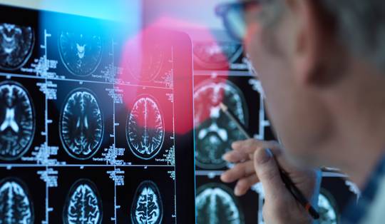 Na ruim een eeuw onderzoek: is het mysterie van dementie oplosbaar?
