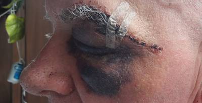 Raadselachtig ongeval: man raakt door onbekende oorzaak zwaargewond