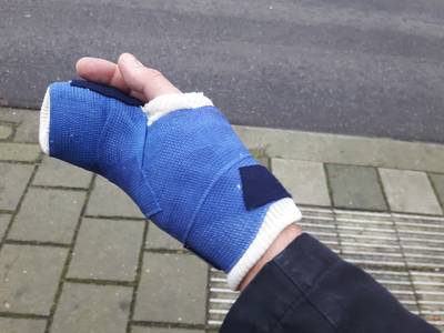 E-bikehater reed Eric (58) uit Doorn van de weg: ‘Ik zag hem lachen toen ik op de grond lag’