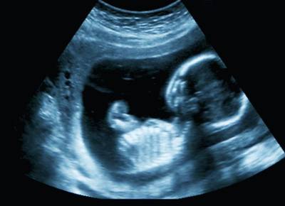 Microplastics ontdekt in placenta's van ongeboren baby's
