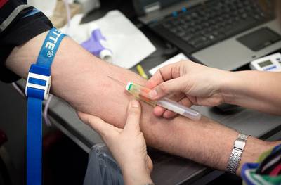 Onderzoek: Q-koorts in chronische vorm wordt kwart van patiënten fataal