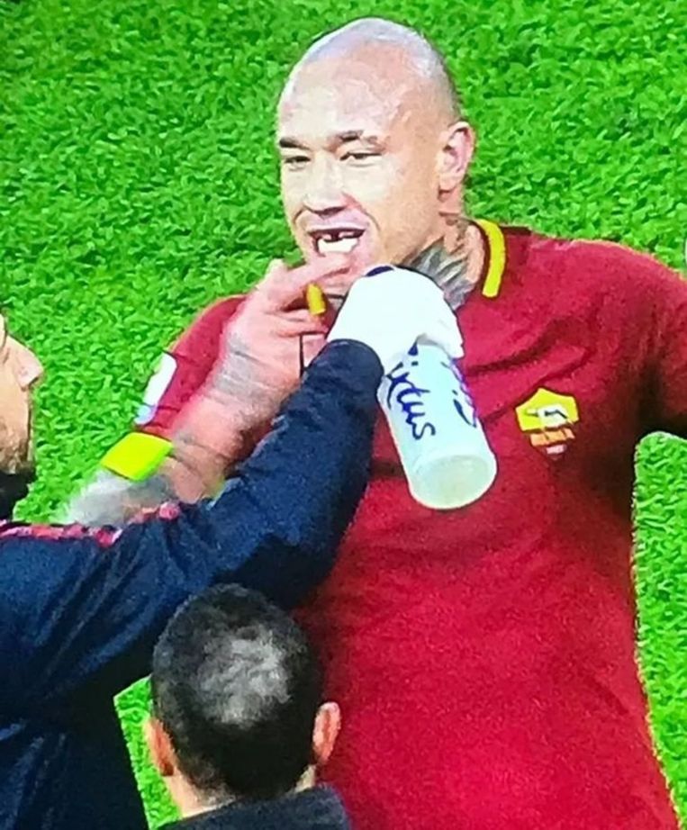 Nainggolan verliest tand na stevige elleboogstoot, maar ...