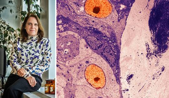 Topvrouw zorg kritisch over screenings: ‘Je spoort ook kankers op die je beter niet had gevonden’