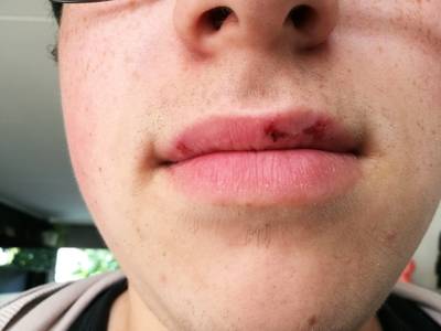 'Mond- en klauwzeer' na schoolkamp tussen koeienvlaaien in de Ardennen