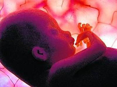 Kamer: vrouw niet verplicht op gesprek voor prenatale-screening op Down