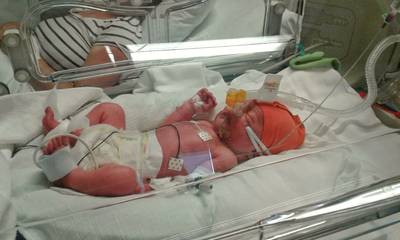 Pasgeboren Teije moedigt Leeuwinnen aan vanuit couveuse van Maasziekenhuis