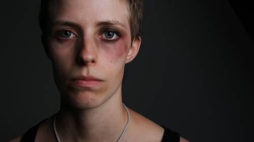 Waarom blijven vrouwen bij man die hen mishandelt? Slachtoffers doen hun verhaal: Voor klacht had ik de fut niet meer”