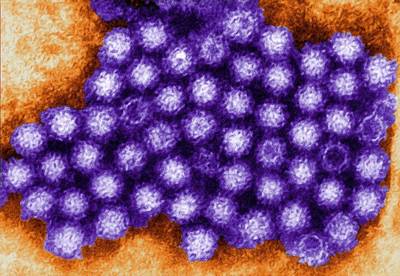 Norovirus uitgebroken in zorgcentrum Liefkenshoek in Heteren, 7 bewoners en 4 personeelsleden ziek
