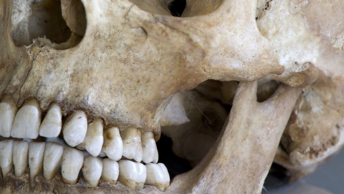 Gebroken tandvulling blootgelegd