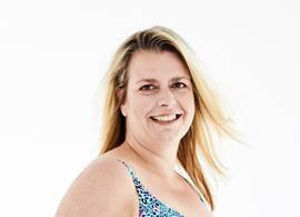 Barbara (46) heeft lipoedeem: “Liposuctie was de enige manier om van het vet af te komen”