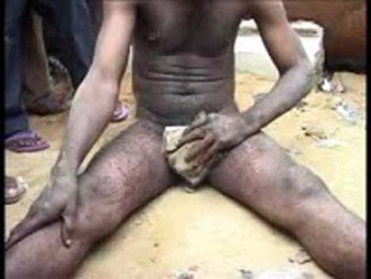 Man met 2 geslachtsdelen