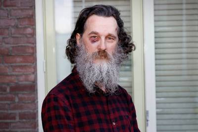 Overvalslachtoffer David kan nauwelijks horen of praten, maar is voor de duvel niet bang