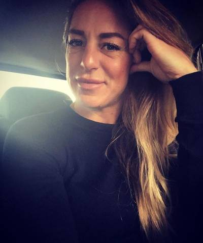 Billy Bakker (Utopia) na kritiek op lipfillers: ‘Ik kan veel hebben’