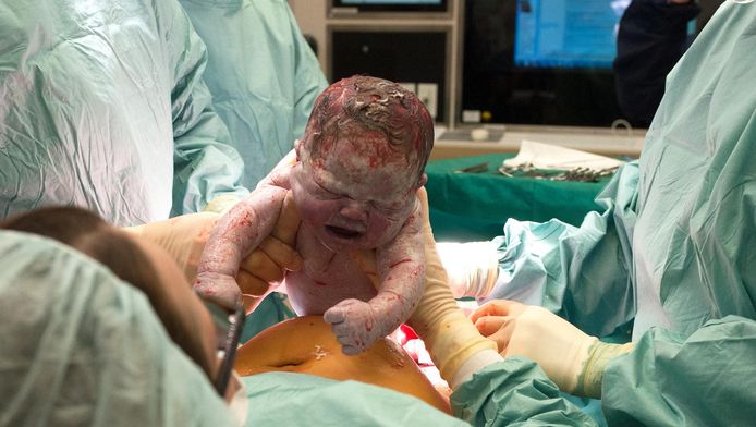 Moeder Haalt Zelf Baby Uit Haar Buik Na Keizersnede Utrecht Ad Nl
