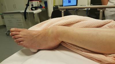 Slachtoffer parkeerruzie met oud-voetballer ligt op intensive care