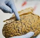 Deze theorie over de oorzaak van autisme kan straks de vuilnisbak in