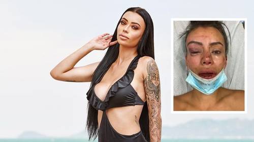 Aanvaller Yasmine Pierards: “Iedereen maakt fouten