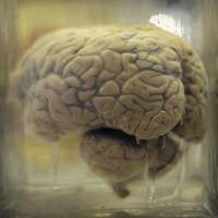 Grote hoeveelheid microplastics aangetroffen in menselijke hersenen: ‘Ik schrik hiervan’