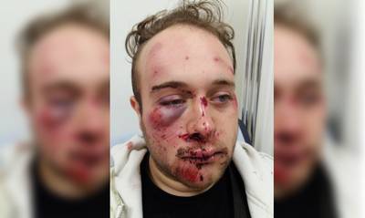 'Tipgever’ mishandeling Brian vraagt 500 euro: ‘Spotten met andermans leed’