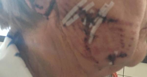 Rottweiler vliegt beheerder vakantiepark naar de keel - De Gelderlander