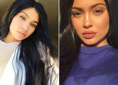 Nieuwe trend bij de plastisch chirurg: eruitzien als je gefilterde selfie