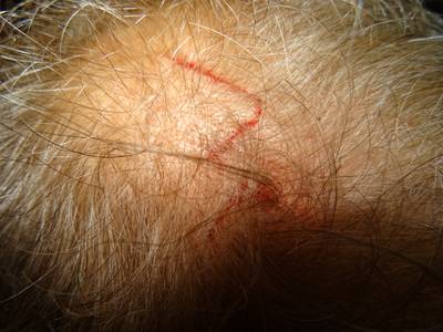 Tot bloedens toe: agressieve bosuil heeft het gemunt op Brabantse fietsers