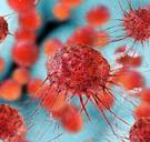 Veelbelovend onderzoek: dit virus kan kanker doden en voorkomen dat hij terugkeert