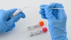 OVERZICHT. Bijna alle cijfers op groen: minder besmettingen, fikse daling in ziekenhuizen en op intensieve zorg