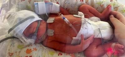 Jonge ouders drieling moeten tweeling 'offeren' voor leven baby Thomas